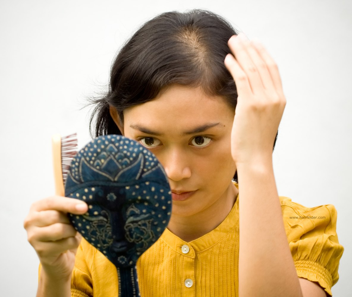 Health Tips to Prevent Hair Loss | Telugu News Info